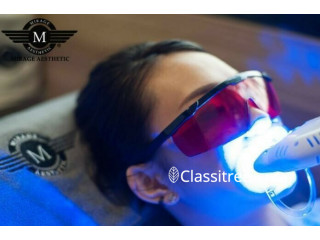 LED Teeth Whitening Treatment in Singapore Mirage Aesthetic