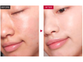 Head Of Skin Booster Treatments no side effect